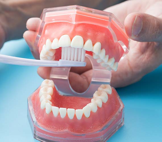 予防・クリーニング