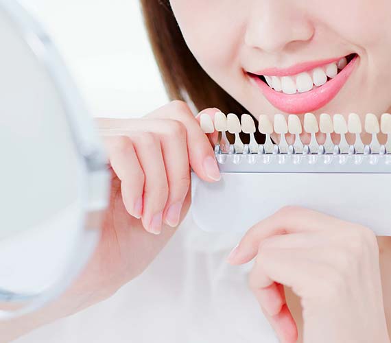 ホワイトニング